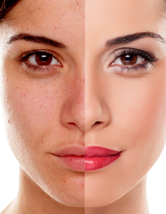 Que tal deixar a sua pele linda, minimizando rugas e marcas de expressão? Conheça o efeito How Mask